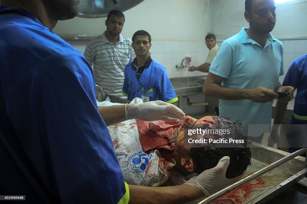 Staff from Al-Shifa Hospital examined  the dead body of a...