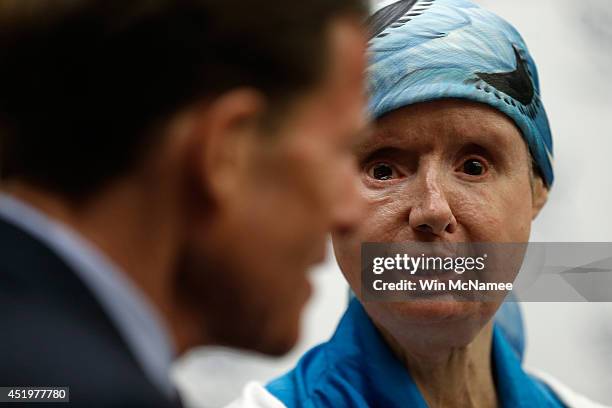 Charla Nash , the victim of a mauling by a pet chimp in Connecticut in 2009 and who underwent a face transplant, speaks at a press conference July...