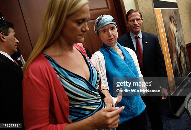 Charla Nash , the victim of a mauling by a pet chimp in Connecticut in 2009 and who underwent a face transplant, departs a press conference with Sen....