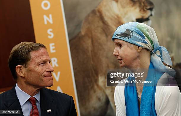 Charla Nash , the victim of a mauling by a pet chimp in Connecticut in 2009 and who underwent a face transplant, speaks with Sen. Richard Blumenthal...