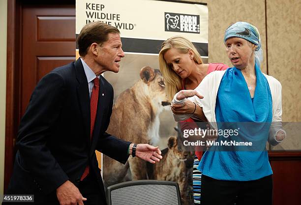 Charla Nash , the victim of a mauling by a pet chimp in Connecticut in 2009 and who underwent a face transplant, is helped to her seat by her friend...