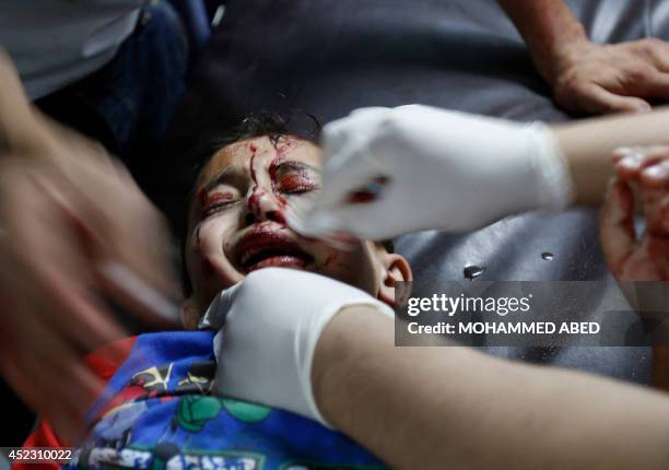 Wounded baby receives treatment at al-Shifa hospital, in Gaza City, on July 18, 2014. Israeli tank fire killed four Palestinians in two separate...