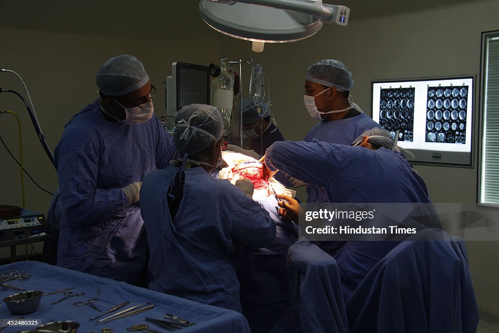 Baby Roona Baby Roona Begum under a skull re-modeling surgery, who was brought ...