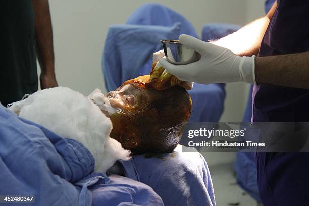 Baby Roona Baby Roona Begum under a skull re-modeling surgery, who was brought ...
