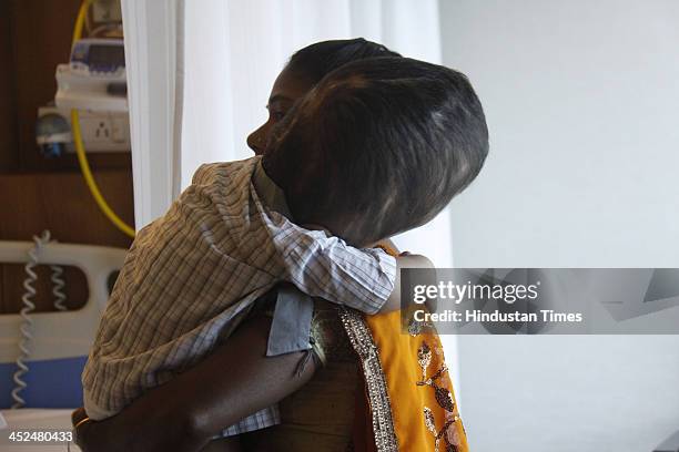 Baby Roona 40 Baby Roona Begum Baby With Hydrocephalus Disease Stock Photos, High ...