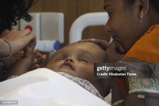 Baby Roona Baby Roona Begum Baby With Hydrocephalus Disease Photos and Premium ...