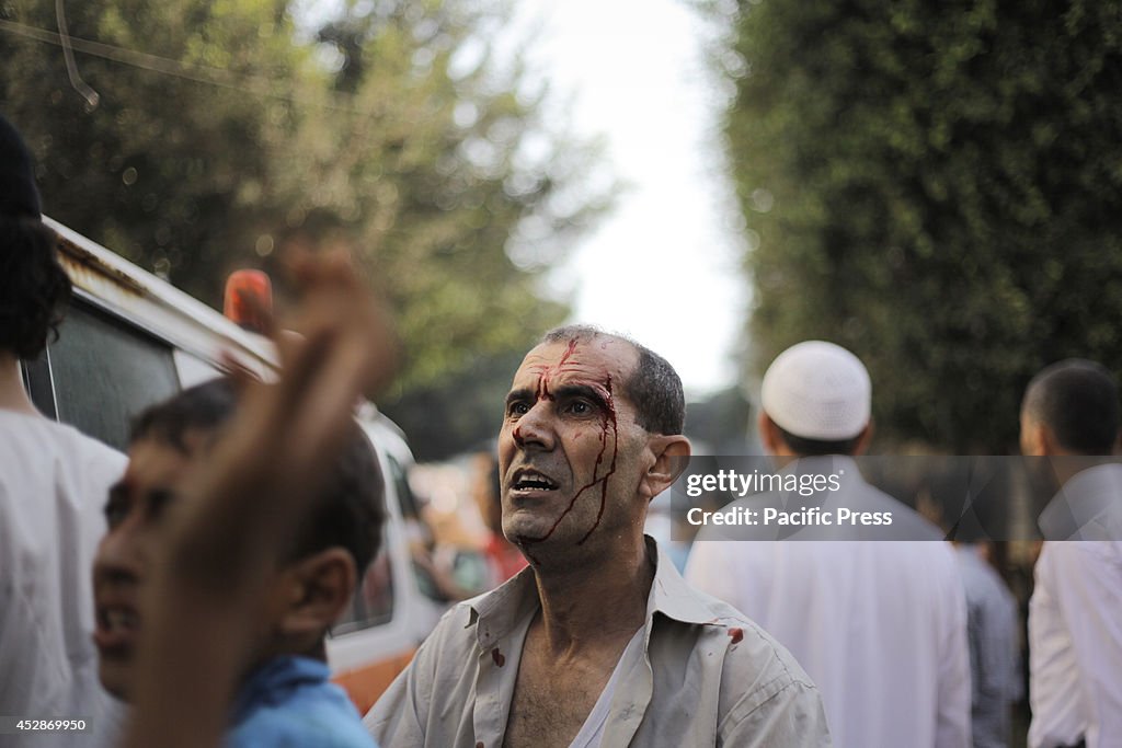 A Palestinian wounded in the raid by the Israeli army on the...