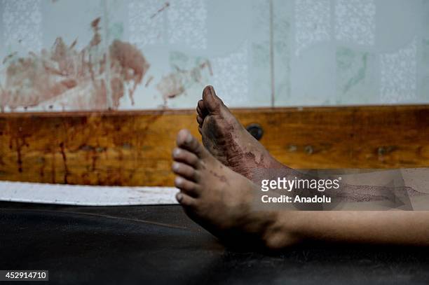 Feet of an injured Palestinian is seen at Beit Lahia's Kamal Adwan hospital in Gaza on July 30, 2014. The death toll from the Israeli shelling of a...