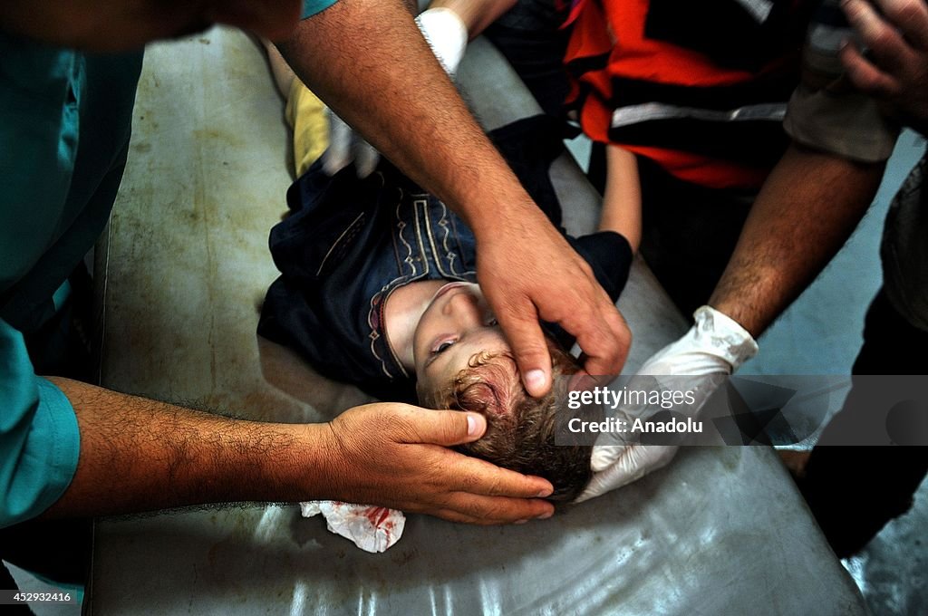 Wounded Palestinian children taken to the Al-Shifa Hospital, Gaza