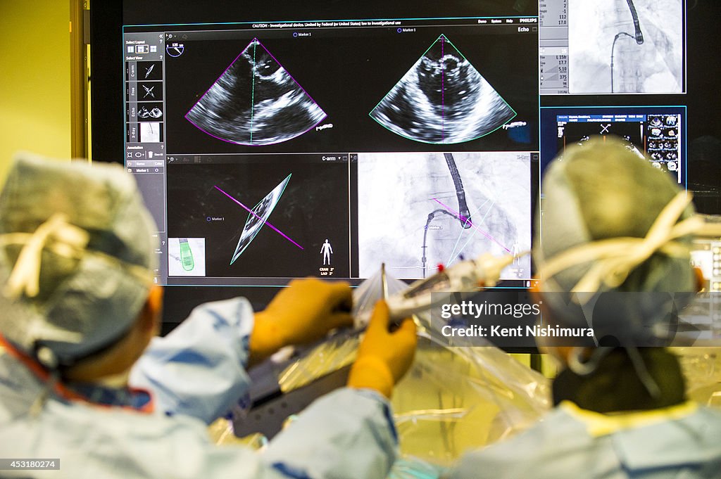 CU Hospital is repairing a woman's leaky heart valve with minimally invasive surgery rather than open-heart surgery
