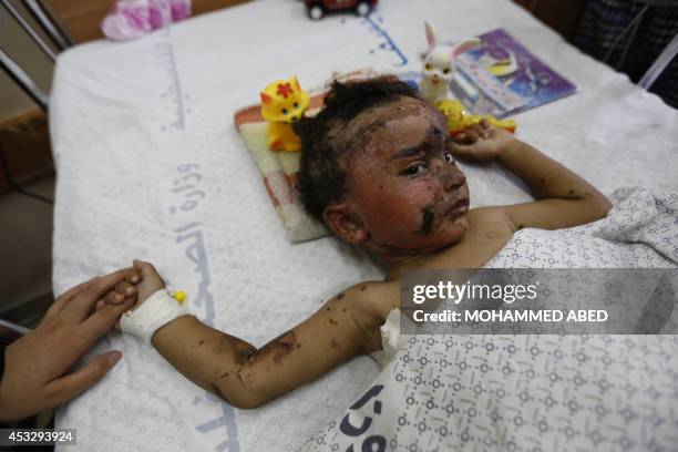 Mohammed Ali Wahdan, a two-year-old Palestnian boy wounded in the latest Israeli assault on the Gaza Strip, lies on his hospital bed as he receives...