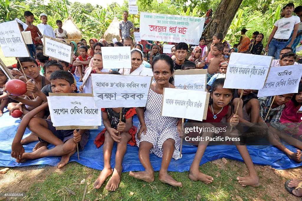 Indian children affected by Fluorosis due to high fluoride...