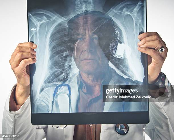 radiologist examining chest x-ray with pacemaker - pacemaker stock pictures, royalty-free photos & images