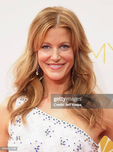 Actress Anna Gunn attends the 66th Annual Primetime Emmy Awards held at Nokia Theatre L.A. Live on August 25, 2014 in Los Angeles, California.