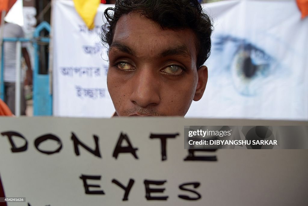 INDIA-HEALTH-EYES