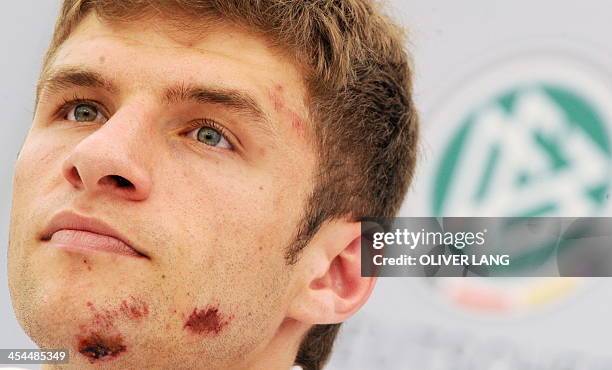 German forward Thomas Mueller, who sustained injuries after having a bicycle accident, addresses a press conference following a training session in...