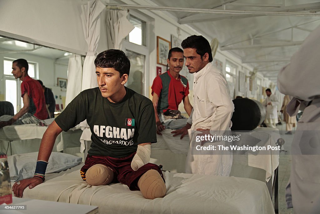 Prosthetics in Kabul, Afghanistan