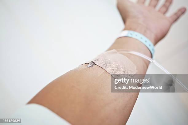 having an intravenous drip in hospital - iv going into an arm stock pictures, royalty-free photos & images