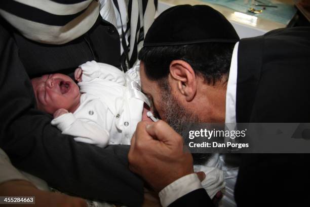During a brit milah ceremony, a mohel performs metzitzah on an eight-day-old Jewish boy following circumcision, Jerusalem, Israel, July 23, 2012. The...