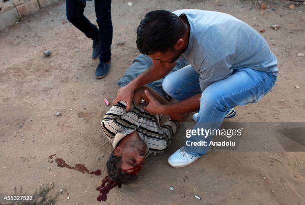 Palestinian man shot in the head with a rubber bullet fired by Israeli soldiers, lays on the ground during the clashes between Palestinians and...