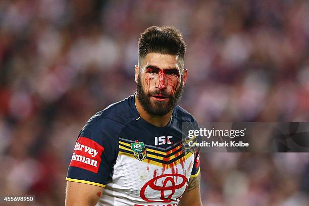 James Tamou of the Cowboys watches on as he bleeds from a head cut during the 1st NRL Semi Final match between the Sydney Roosters and the North...