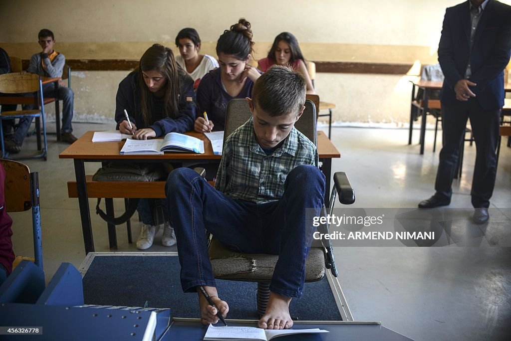 KOSOVO-DISABILITY-ARMLESS-BOY