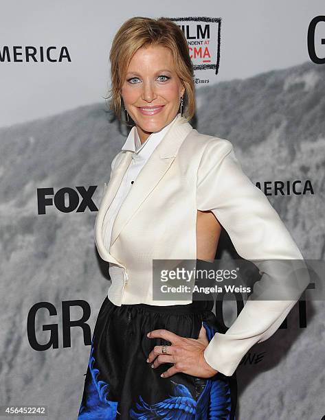 Actress Anna Gunn attends the Film Independent Screening of 'Gracepoint' at Bing Theatre at LACMA on September 30, 2014 in Los Angeles, California.