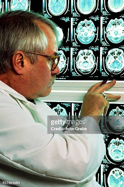 Radiologist reviewing CT scans.