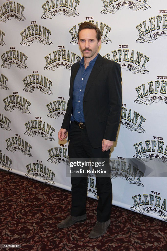 "The Elephant Man" Broadway Cast Photo Call