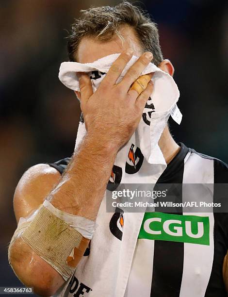 Travis Cloke of the Magpies looks on during the 2016 AFL Round 15 match between the Carlton Blues and the Collingwood Magpies at the Melbourne...