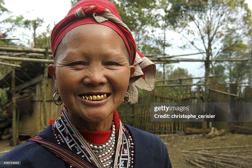 Red Dzao woman with golden teeth