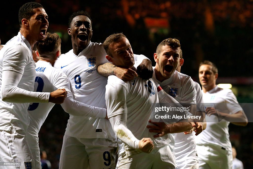 Scotland v England - International Friendly