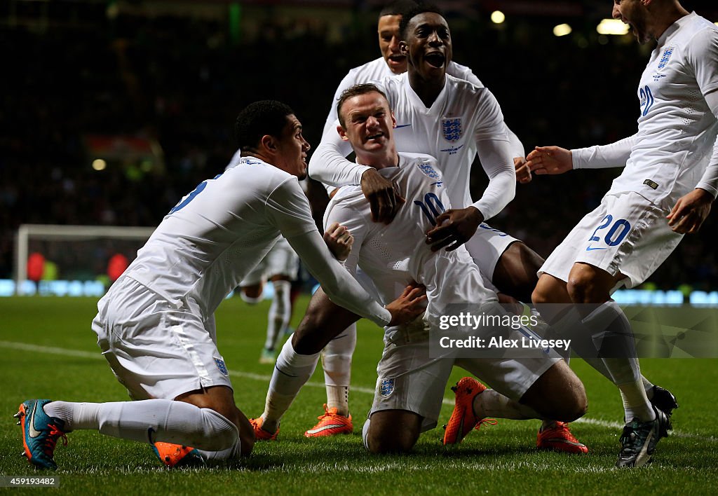 Scotland v England - International Friendly