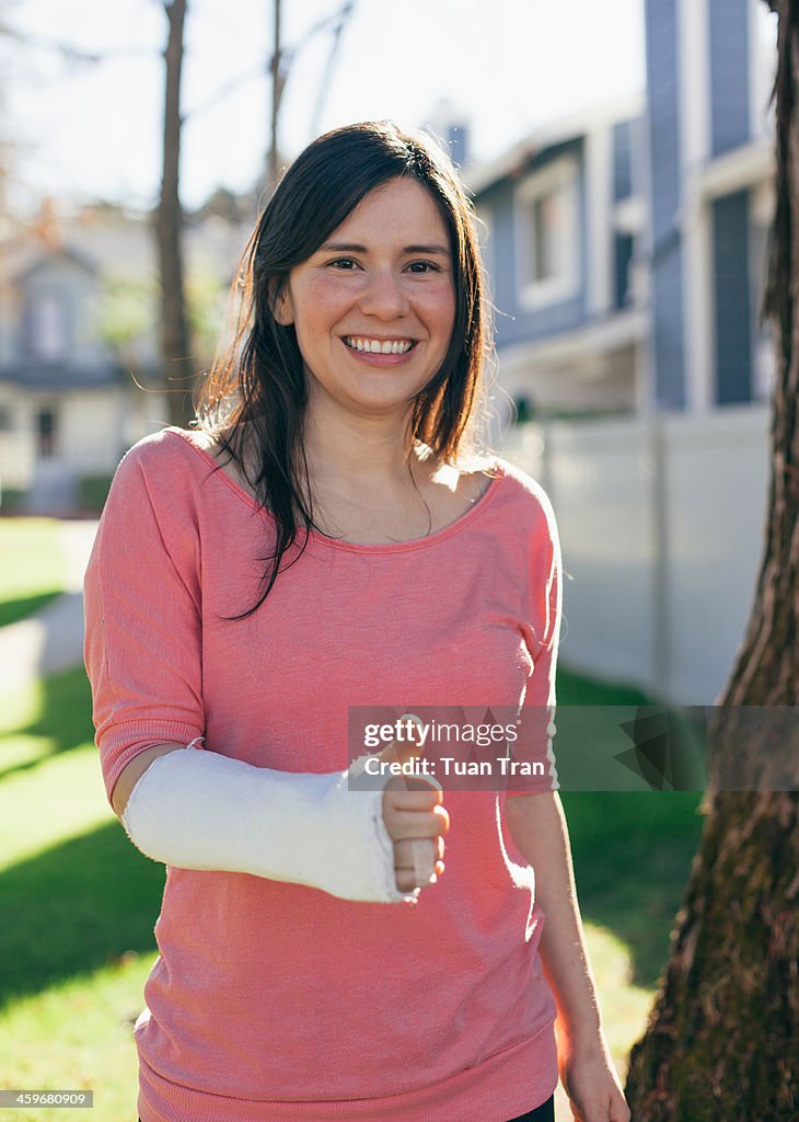 Woman giving thumbs up sign with broken arm in cas