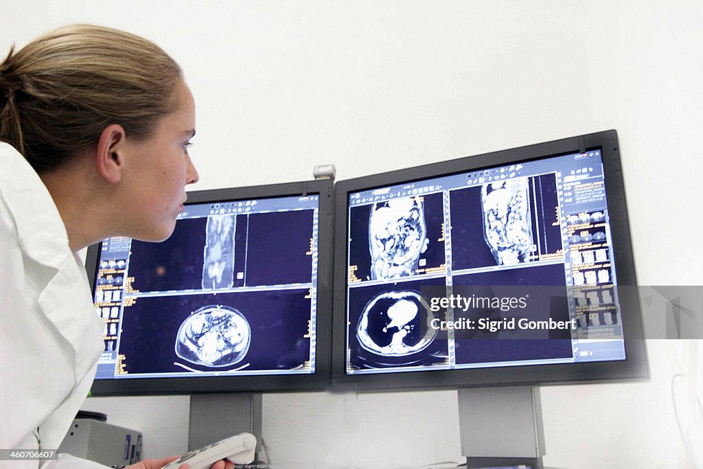 Female doctor examining ct scans on computer monitors