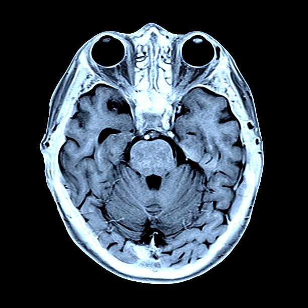 Red Brain Scan 8,865 Color Brain Scan Stock Photos, High-Res Pictures, and Images ...