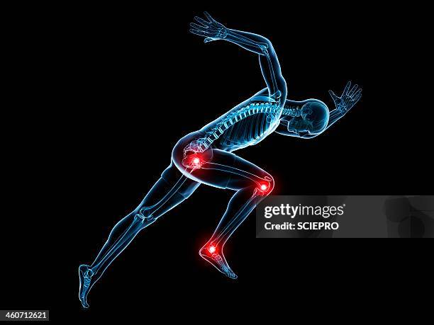 painful joints, artwork - female knee pain stock-grafiken, -clipart, -cartoons und -symbole