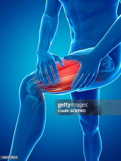 stockillustraties, clipart, cartoons en iconen met leg cramp, artwork - spier