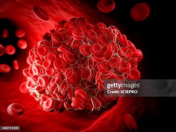 bildbanksillustrationer, clip art samt tecknat material och ikoner med blood clot, artwork - blodpropp