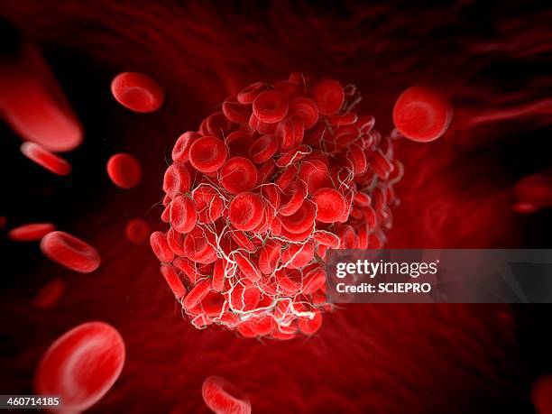 bildbanksillustrationer, clip art samt tecknat material och ikoner med blood clot, artwork - blodpropp