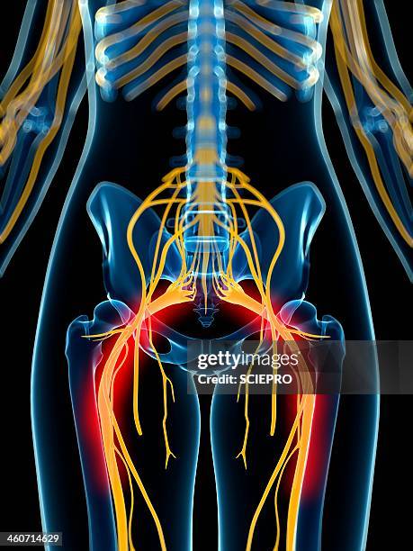 painful sciatic nerve artwork - sciatic stock illustrations