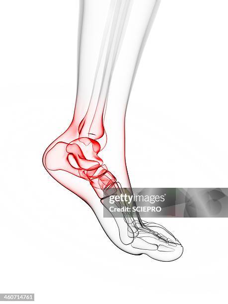 painful ankle, artwork - foot pain stock illustrations