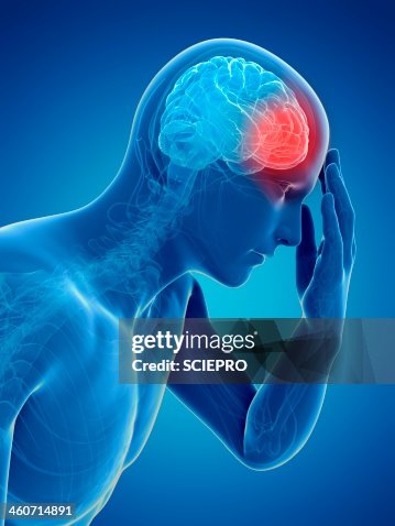 Headache, artwork Headache, artwork