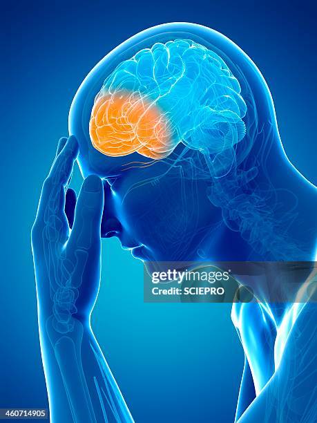 Ilustraciones de Dolor De Cabeza - Getty Images Ilustraciones de Dolor De Cabeza - Getty Images