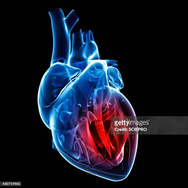 heart attack, artwork - human internal organ stock illustrations
