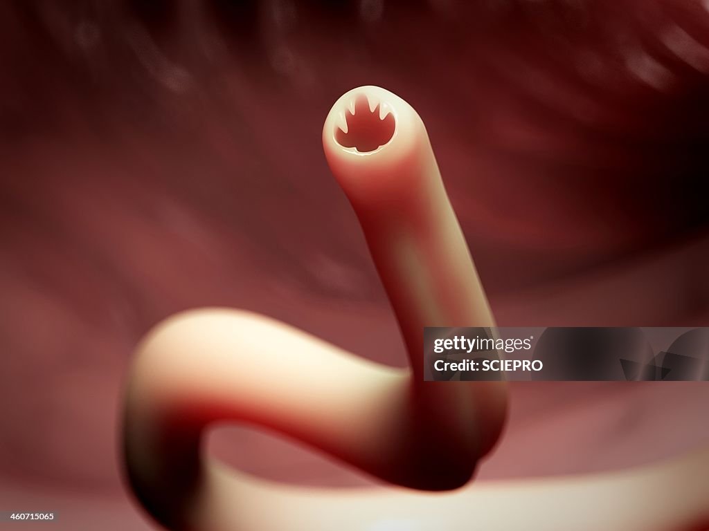 Hook worm, artwork