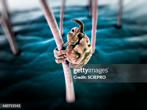 Pubic louse, artwork Pubic louse, artwork