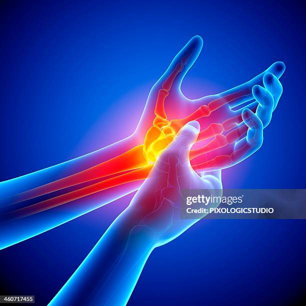 wrist pain, artwork - tender stock illustrations