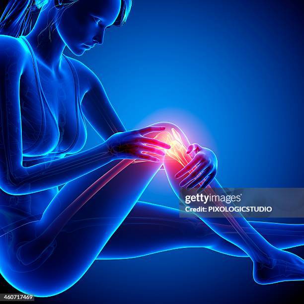 knee pain, artwork - knee stock illustrations