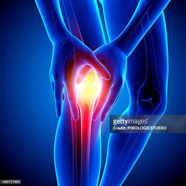 knee pain, artwork - inflammation stock illustrations